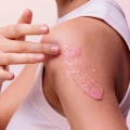 raspberry-peeling_3.webp